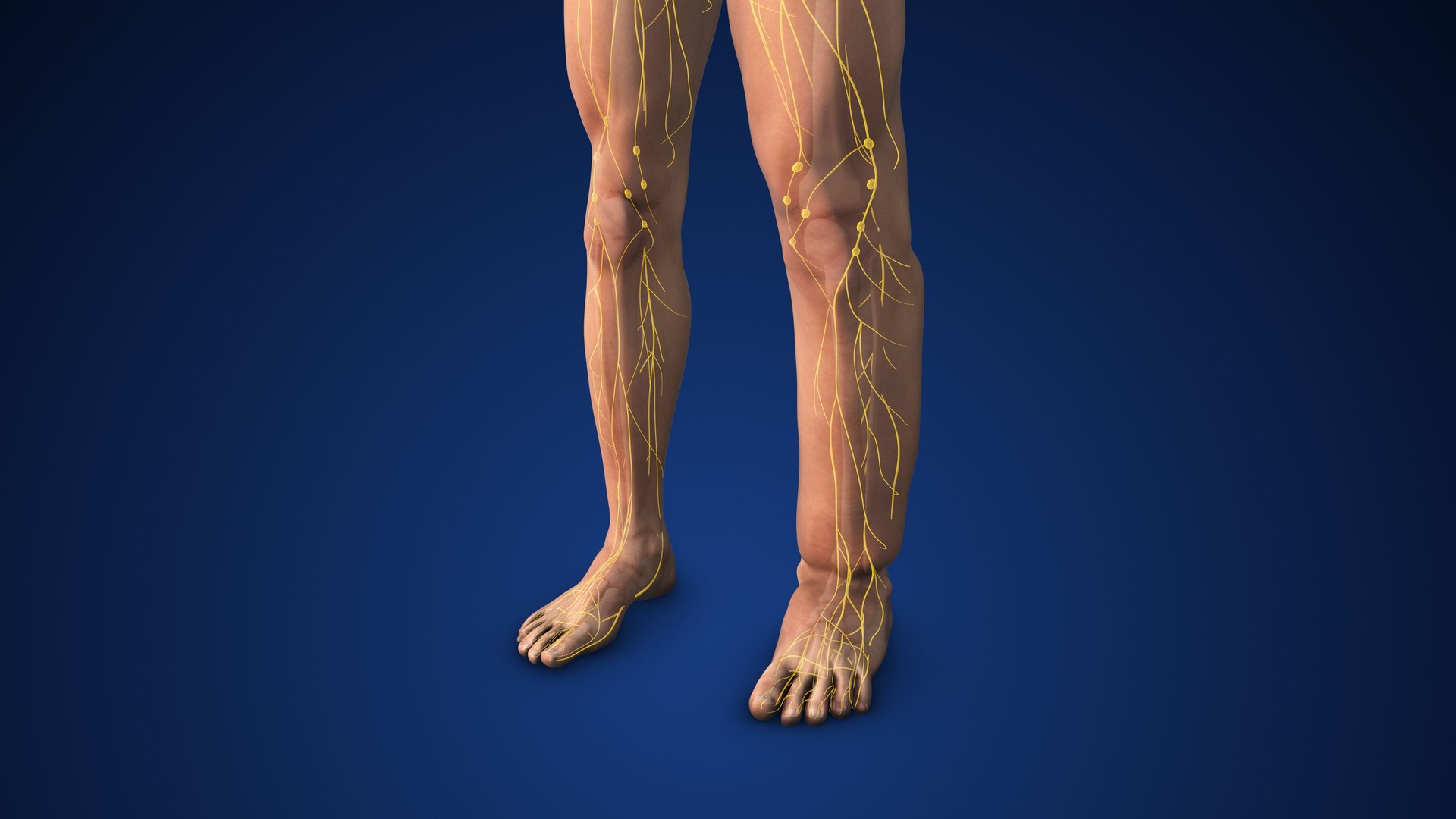 Medizinische Animation des Lymphödems in den Beinen